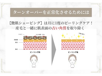 エオナ(EONA)の写真