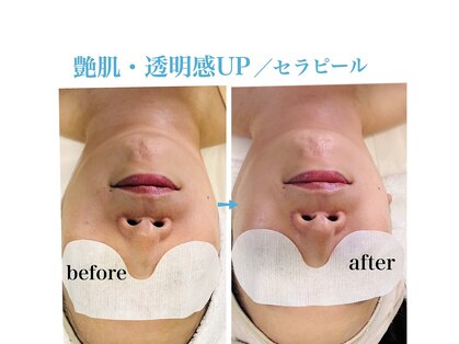ムク(MUKU 無垢)の写真