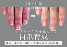 ヴェールリム(verl lim)