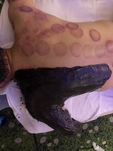 中国整体 らくらく堂/肩痛辛さ改善漢方温熱パック★