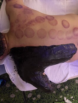 中国整体 らくらく堂/肩痛辛さ改善漢方温熱パック★