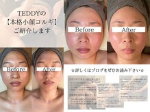 テディビューティーケア(TEDDY beauty care)の雰囲気（TEDDYこだわりの本格小顔コルギ♪ボディ/機械との組み合わせも◎）