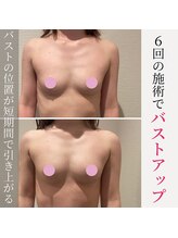 アーレ 博多本店(ARE)/当店なら短期間でバストアップ♪