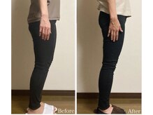 ユーフルール/念願の太ももスッキリ！