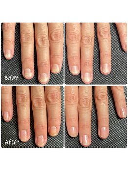 ルームイチマルイチネイルズ(Room101Nails.)/自爪育成・最強のネイルケア鳥取