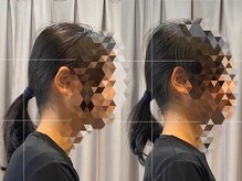 かわさき整体院/20代女性ビフォーアフター