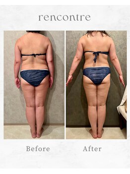 ランコント(rencontre)/肩こり/リンパ/ヘッドスパ/痩身