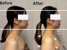 ベール(BEHL)/コルギのBeforeAfter