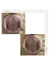 ファロンビューティー(fallon beauty)/お客様ビフォー×アフター