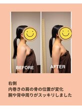 イーズリー(easily)/BEFORE→AFTER