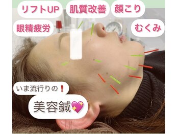 リリーフ(relief)/小顔ケアなら美容鍼！！