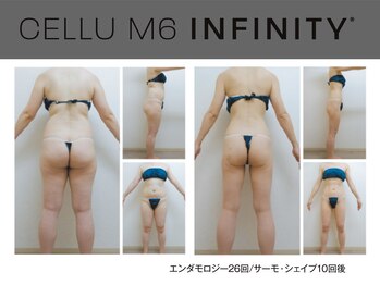 ビューティーリバース センター北店/エンダモロジーインフィニティ