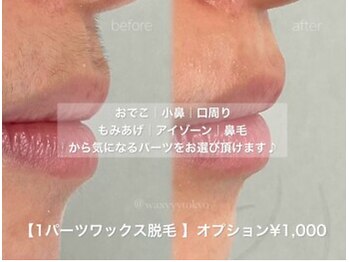 ハリウッドブロウリフト ワクシー 表参道店(HOLLYWOOD BROW LIFT WAXYYY.)/オプション★ワックス脱毛1000円