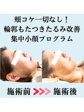 ボナボナ 仙台立町(BONA BONA)/たるみ無くして若くなりたい！