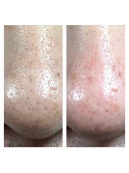 スリーズララ(Cerise LaLa)/