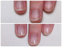 寺子屋ビューティーズ(寺子屋Beauty's)/自爪育成で変わりませんか？