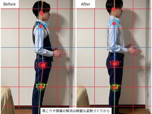 テラス 千葉(TERAS)の雰囲気（骨格の歪みを整えることで、肩こり・腰痛を根本的に解消◎）