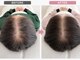 サラシック(salachic)の写真