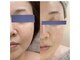 リッチベル(richbelle)の写真