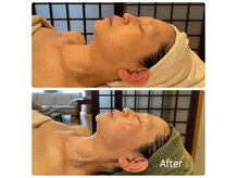 エクセレントビューティーサロン 艶(EN)の雰囲気（フェイスライン・顎の肉張り・小顔！毛穴ハリ艶肌にVENUSリフト）