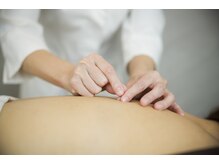 デルタエヌピー63+(δnp63+)/お客様施術例【小顔/薬院/福岡】