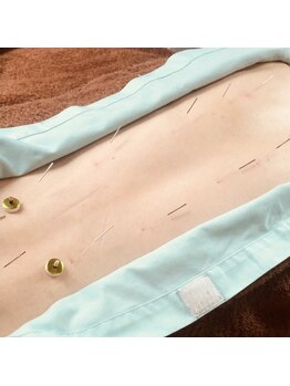 フィットジユウガオカ(Fit_Jiyugaoka)/美しい背中でエイジングケア