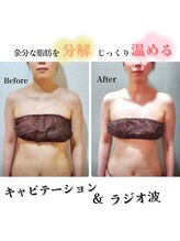 セブンスタイルイ 石巻店(7style)/【お客様ビフォーアフター】