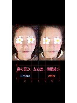 美容矯正サロン レレポノ(LELEPONO)/