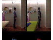 和奏治療院/お腹を鍛えて反り腰改善！