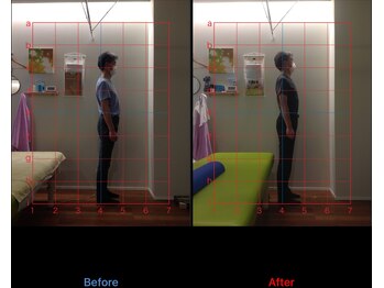 和奏治療院/お腹を鍛えて反り腰改善!