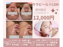ソルティ サロン(salty salon)