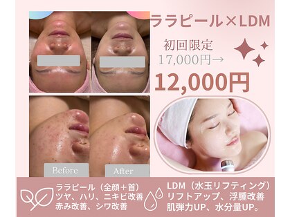 ソルティ サロン(salty salon)の写真