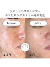 ユヌランコント 岐阜店(Une rencontre)/エンビロン