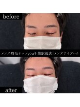 ユー 千葉駅前店(you)/ビフォ－アフター写真