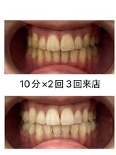 エム(M)/３回来店のお客様