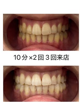 エム(M)/３回来店のお客様