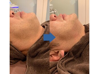 ピュアトゥルー 岐阜西店(PureTrue)/男性も小顔に！