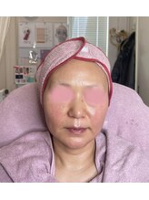 リフティングラボ(LIFTING LAB)/