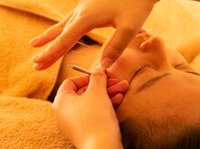 ハリ パール(HARI PEARL)/美容鍼/小顔・リフトアップ