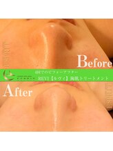 エスプリ 銀座店/ハーブピーリング銀座