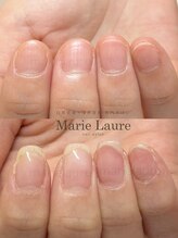 マリーロール 梅田店(Marie Laure)/深爪矯正/自爪育成/自爪風