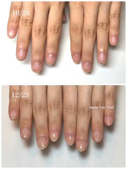 マイントゥ ネイル(mine too nail)/育成ネイルで別人の手に♪