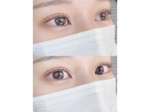 シュシュ(shushu)