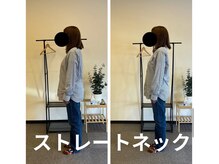 カワル整体 長嶺院/ストレートネック
