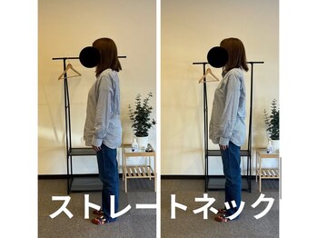 カワル整体 長嶺院/ストレートネック