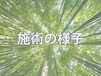 エッセン(ESSEN)/検査後にいよいよ施術となります