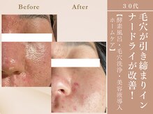 ケムズ インプルーブメントサロン(KMS IMPROVEMENT salon)/