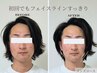 メンズコース｜疲れ顔・第一印象改善◎清潔感&垢抜け印象へ［小顔_小顔矯正］