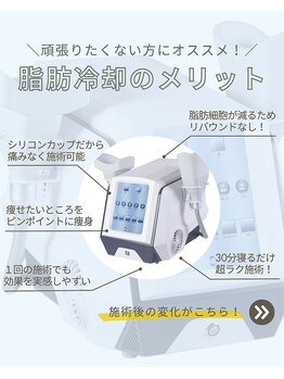 イエス マイサロン(yes My Salon)/脂肪冷却説明2