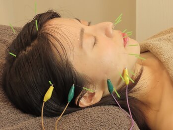 プラス(APLUS)/美容鍼施術風景